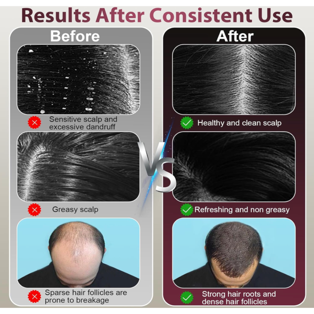 Peine Masajeador con Guía Líquida